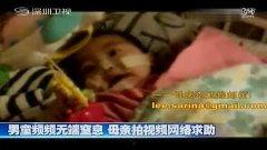 真空袋窒息视频,揭秘家庭安全隐患